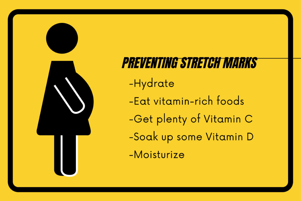 preventing stretch marks during your pregnancy