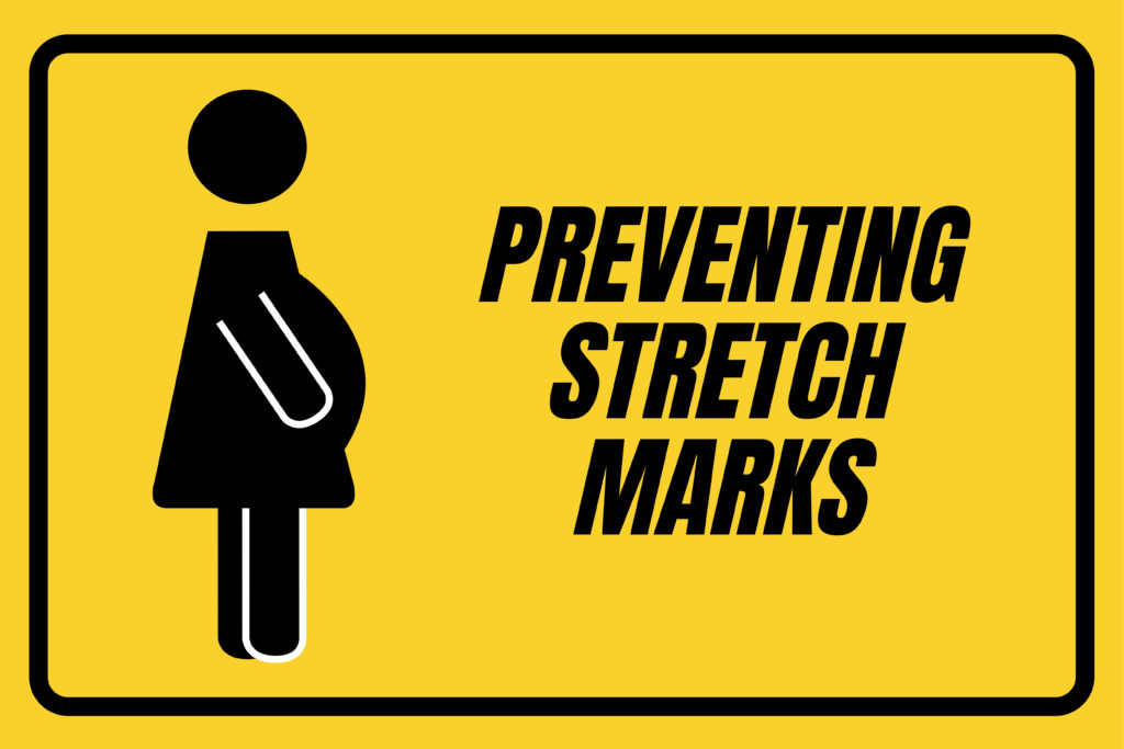 preventing stretch marks during your pregnancy